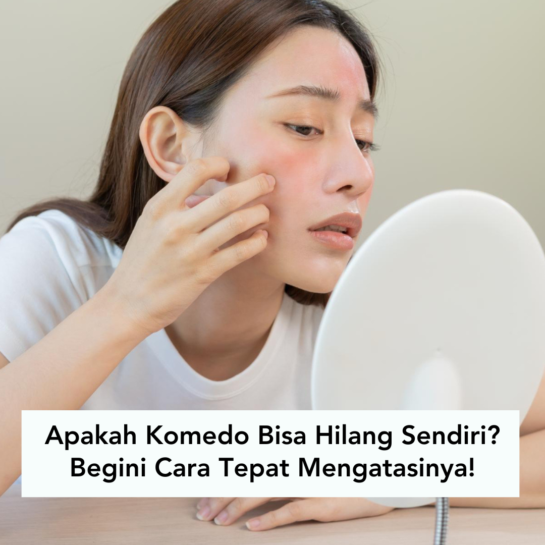 Seorang wanita sedang bercermin melihat wajahnya yang berkomedo Seorang wanita sedang bercermin melihat wajahnya yang berkomedo