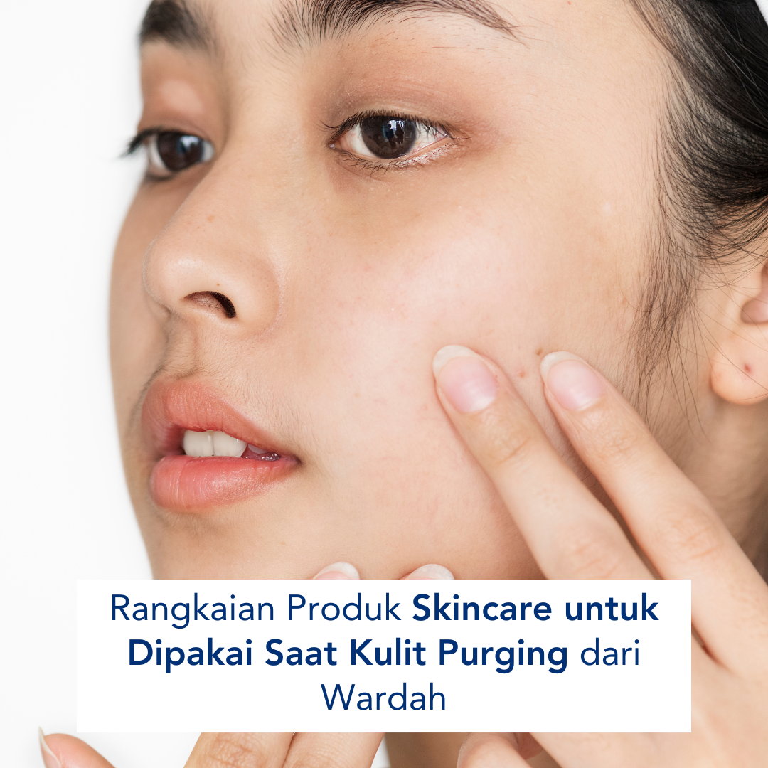 Skincare untuk Dipakai Saat Kulit Purging